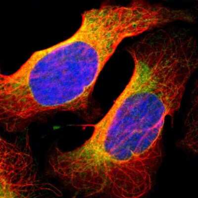 Immunocytochemistry/ Immunofluorescence BCAP31 Antibody