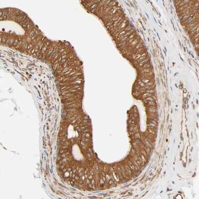 Immunohistochemistry-Paraffin BCAP31 Antibody