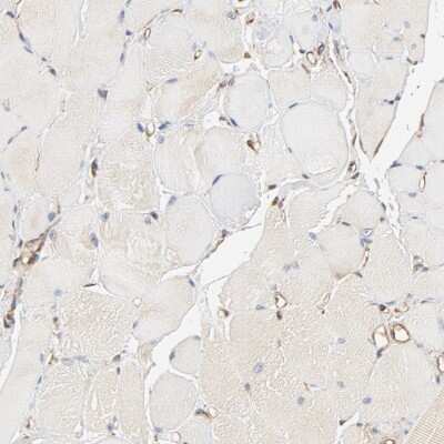 Immunohistochemistry-Paraffin BCAP31 Antibody