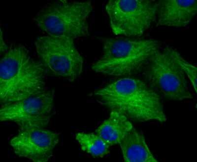 Immunocytochemistry/Immunofluorescence: BCAP31 Antibody (JG37-81) [NBP2-75416] - Staining BAP31 in A549 cells (green). The nuclear counter stain is DAPI (blue). Cells were fixed in paraformaldehyde, permeabilised with 0.25% Triton X100/PBS.
