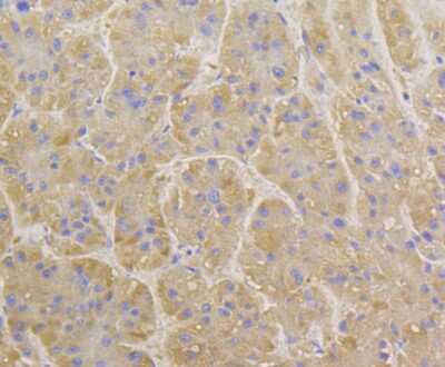 Immunohistochemistry-Paraffin: BCAP31 Antibody (JG37-81) [NBP2-75416] - Analysis of paraffin-embedded human liver tissue using anti-BAP31 antibody. Counter stained with hematoxylin.