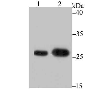 Western Blot: BCAP31 Antibody (JG37-81) [NBP2-75416] - Analysis of BAP31 on different lysates using anti-BAP31 antibody at 1/1,000 dilution.Positive control:Lane 1: A431                Lane 2: SK-Br-3