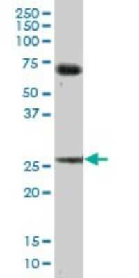 Western Blot: BCAP31 Antibody [H00010134-B01P] - Analysis of BCAP31 expression in human pancreas.
