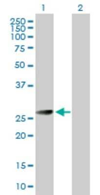 Western Blot: BCAP31 Antibody [H00010134-D01P] - Analysis of BCAP31 expression in transfected 293T cell line by BCAP31 polyclonal antibody.Lane 1: BCAP31 transfected lysate(28.00 KDa).Lane 2: Non-transfected lysate.