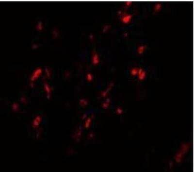 Immunocytochemistry/Immunofluorescence: BCAS1 Antibody [NBP1-77123] - Human Breast Carcinoma cells with BCAS1 antibody at 20 ug/mL.