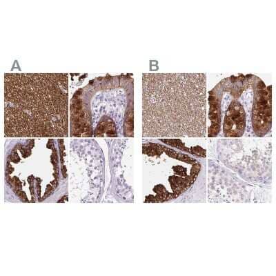 <b>Independent Antibodies Validation. </b>Immunohistochemistry-Paraffin: BCAS1 Antibody [NBP2-38658] - Staining of human cerebral cortex, colon, prostate and testis using Anti-BCAS1 antibody NBP2-38658 (A) shows similar protein distribution across tissues to independent antibody NBP2-38736 (B).