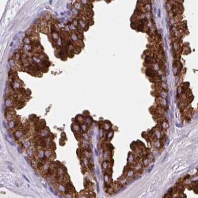 Immunohistochemistry-Paraffin: BCAS1 Antibody [NBP2-38658] - Staining of human prostate.