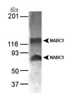 Western Blot: BCAS1 Antibody [NB100-681] - Detection of NABC1 in MCF-7 whole cell lysate (15 ug) using a 1:1,000 dilution of NB 100-681.