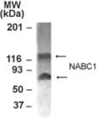 Western Blot: BCAS1 Antibody [NB100-681] - Western blot analysis of BCAS1 from 15 ug of MCF-7 cell lysate using NB100-681 at 1:1000 dilution. BCAS1 is a 60 kDa protein: however it forms homodimers, which are detected in MCF-7 cells.