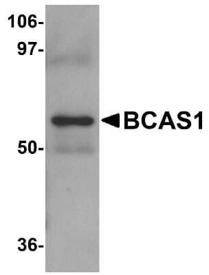 Western Blot: BCAS1 Antibody [NBP1-77123] - human lung tissue lysate with BCAS1 antibody at 1 ug/ml.