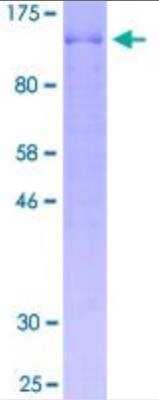 SDS-PAGE Recombinant Human BCAS1 Protein