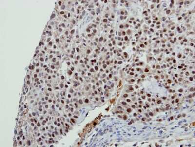 Immunohistochemistry-Paraffin: BCAS2 Antibody [NBP2-15551] - Immunohistochemical analysis of paraffin-embedded J5 xenograft, using antibody at 1:100 dilution.