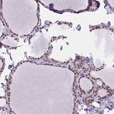 Immunohistochemistry-Paraffin: BCAS2 Antibody [NBP2-49532] - Staining of human thyroid gland shows high expression.