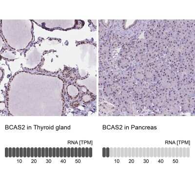 <b>Orthogonal Strategies Validation. </b>Immunohistochemistry-Paraffin: BCAS2 Antibody [NBP2-49532] - Staining in human thyroid gland and pancreas tissues using anti-BCAS2 antibody. Corresponding BCAS2 RNA-seq data are presented for the same tissues.