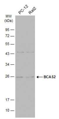 Western Blot: BCAS2 Antibody [NBP2-15551] - Various whole cell extracts (30 ug) were separated by 12% SDS-PAGE, and the membrane was blotted with BCAS2 antibody diluted at 1:1000. HRP-conjugated anti-rabbit IgG antibody was used to detect the primary antibody.