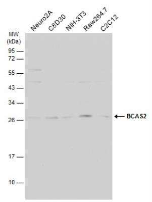 Western Blot: BCAS2 Antibody [NBP2-15551] - Various whole cell extracts (30 ug) were separated by 12% SDS-PAGE, and the membrane was blotted with BCAS2 antibody diluted at 1:1000. HRP-conjugated anti-rabbit IgG antibody was used to detect the primary antibody.