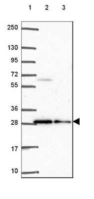 Western Blot: BCAS2 Antibody [NBP2-49532] - Lane 1: Marker [kDa] 250, 130, 95, 72, 55, 36, 28, 17, 10Lane 2: Human cell line RT-4Lane 3: Human cell line U-251 MG