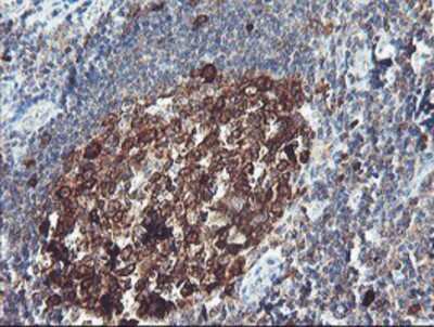 Immunohistochemistry-Paraffin: BCAT1 Antibody (3F5) [NBP2-01826] - Staining of paraffin-embedded Human tonsil using anti-BCAT1 mouse monoclonal antibody.