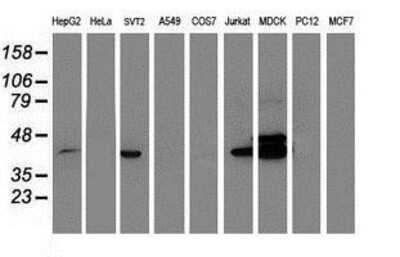 Western Blot: BCAT1 Antibody (3F5) [NBP2-01826] Analysis of extracts (35ug) from 9 different cell lines by using anti-BCAT1 monoclonal antibody.