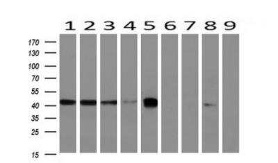 Western Blot: BCAT1 Antibody (3F5) [NBP2-01826] - Analysis of extracts (10ug) from 9 Human tissue by using anti-BCAT1 monoclonal antibody at 1:200 (1: Testis; 2: Omentum; 3: Uterus; 4: Breast; 5: Brain; 6: Liver; 7: Ovary; 8: Thyroid gland; 9: Colon)