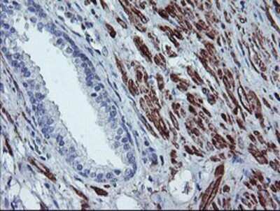 Immunohistochemistry: BCAT1 Antibody (OTI3F5) - Azide and BSA Free [NBP2-70242] - Staining of paraffin-embedded Human prostate tissue using anti-BCAT1 mouse monoclonal antibody.