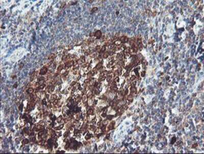 Immunohistochemistry: BCAT1 Antibody (OTI3F5) - Azide and BSA Free [NBP2-70242] - Staining of paraffin-embedded Human tonsil using anti-BCAT1 mouse monoclonal antibody.