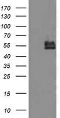 Western Blot: BCAT1 Antibody (OTI3F5) - Azide and BSA Free [NBP2-70242] - HEK293T cells were transfected with the pCMV6-ENTRY control (Left lane) or pCMV6-ENTRY BCAT1 (Right lane) cDNA for 48 hrs and lysed. Equivalent amounts of cell lysates (5 ug per lane) were separated by SDS-PAGE and immunoblotted with anti-BCAT1.