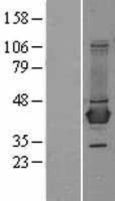 Western Blot BCAT1 Overexpression Lysate