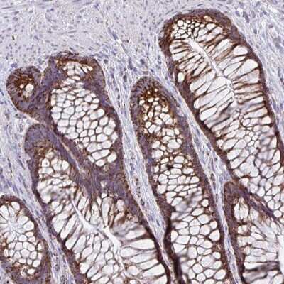 Immunohistochemistry-Paraffin: BCAT2 Antibody [NBP2-33705] - Staining of human rectum shows strong cytoplasmic positivity in glandular cells.