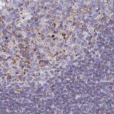 Immunohistochemistry-Paraffin: BCAT2 Antibody [NBP2-33705] - Staining of tonsil.