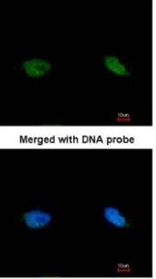 Immunocytochemistry/ Immunofluorescence BCCIP Antibody