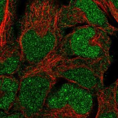 Immunocytochemistry/Immunofluorescence: BCCIP Antibody [NBP2-55218] - Staining of human cell line HEK 293 shows localization to nucleoplasm & cytosol.