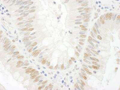 Immunohistochemistry BCCIP Antibody - BSA Free