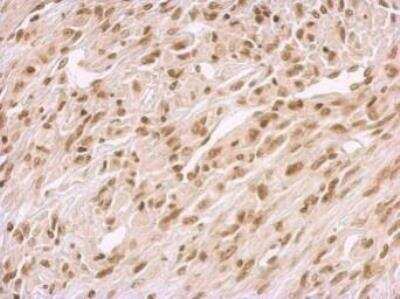 Immunohistochemistry-Paraffin BCCIP Antibody