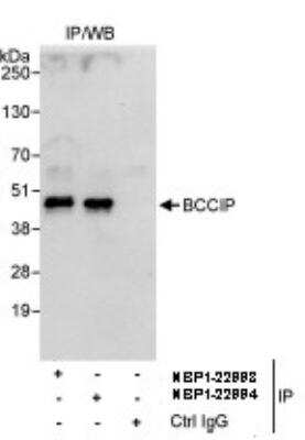 Immunoprecipitation: BCCIP Antibody [NBP1-22994] - Whole cell lysate (1 mg for IP, 20% of IP loaded) from HeLa cells. Antibodies: Affinity purified rabbit anti-BCCIP antibody used for IP at 3 mcg/mg lysate. BCCIP was also immunoprecipitated by rabbit anti- BCCIP antibody NBP1-22993, which recognizes an upstream epitope.