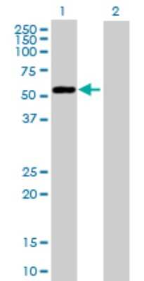 Western Blot: BCCIP Antibody [H00056647-B01P] - Analysis of BCCIP expression in transfected 293T cell line by BCCIP polyclonal antibody.  Lane 1: BCCIP transfected lysate(34.54 KDa). Lane 2: Non-transfected lysate.
