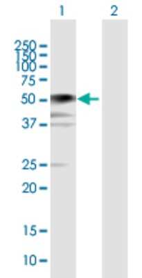 Western Blot: BCCIP Antibody [H00056647-B02P] - Analysis of BCCIP expression in transfected 293T cell line by BCCIP polyclonal antibody.  Lane 1: BCCIP transfected lysate(35.42 KDa). Lane 2: Non-transfected lysate.