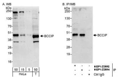 Western Blot: BCCIP Antibody [NBP1-22993] - Whole cell lysate from HeLa and 293T cells. BCCIP was also immunoprecipitated by rabbit anti-BCCIP antibody NBP1-22994.