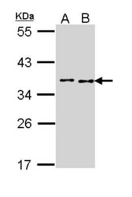 Western Blot BCCIP Antibody