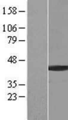 Western Blot: BCCIP Overexpression Lysate (Adult Normal) [NBL1-07940] Left-Empty vector transfected control cell lysate (HEK293 cell lysate); Right -Over-expression Lysate for BCCIP.