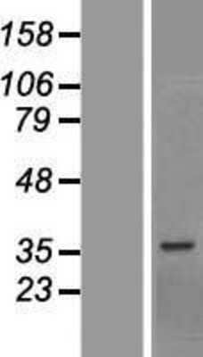 Western Blot BCCIP Overexpression Lysate