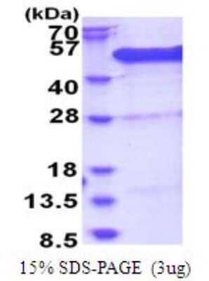 SDS-PAGE Recombinant Human BCCIP His Protein