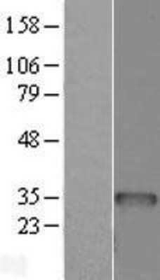 Western Blot: BCDIN3D Overexpression Lysate (Adult Normal) [NBL1-07941] Left-Empty vector transfected control cell lysate (HEK293 cell lysate); Right -Over-expression Lysate for BCDIN3D.