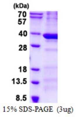 SDS-PAGE Recombinant Human BCDIN3D His Protein