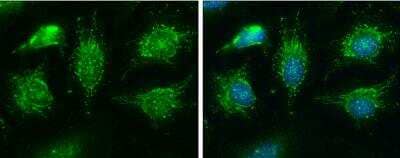 Immunocytochemistry/Immunofluorescence: BCKDHA Antibody [NBP2-15552] - HeLa cells were fixed in ice-cold MeOH for 5 min. Green: BCKDHA protein stained by BCKDHA antibody [C1C3]  diluted at 1:400. Blue: Hoechst 33342 staining.