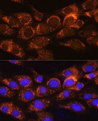 Immunocytochemistry/Immunofluorescence: BCKDHA Antibody [NBP2-92584] - Analysis of NIH/3T3 cells using BCKDHA Rabbit pAb at dilution of 1:100. Blue: DAPI for nuclear staining.