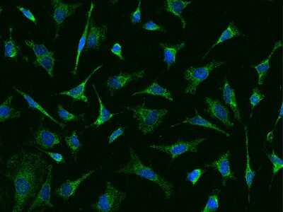 Immunocytochemistry/Immunofluorescence: BCKDHA Antibody [NBP2-97503] - Immunofluorescence staining of BCKDHA in Hela cells. Cells were fixed with 4% PFA, permeabilzed with 0.1% Triton X-100 in PBS, blocked with 10% serum, and incubated with rabbit anti-Human BCKDHA polyclonal antibody (dilution ratio 1:500) at 4C overnight. Then cells were stained with the Alexa Fluor(R)488-conjugated Goat Anti-rabbit IgG secondary antibody (green) and counterstained with DAPI (blue).Positive staining was localized to Cytoplasm.