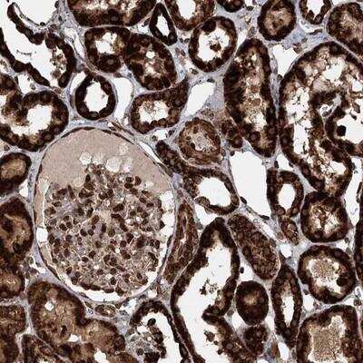 Immunohistochemistry-Paraffin: BCKDHA Antibody [NBP1-81022] - Staining of human kidney shows strong granular positivity in cells in tubules.