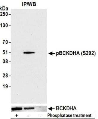 Immunoprecipitation: BCKDHA Antibody [NBP3-14681] - Whole cell lysate (1 mg per IP reaction, 20% of IP loaded) from Hep-G2 cells treated with phosphatase (+) or mock treated (-).Rabbit anti-BCKDHA antibody  used for IP at 6 ug per reaction. For blotting immunoprecipitated rabbit anti-Phospho BCKDHA  recombinant monoclonal antibody was used at 1:1000 (upper panel) was used at 1 ug/ml (lower panel). HRP-conjugated goat anti-rabbit IgG  Chemiluminescence with an exposure time of 30 seconds.