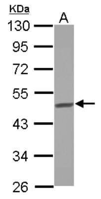 Western Blot: BCKDHA Antibody [NBP2-15552] - Sample (30 ug of whole cell lysate) A: HepG2 10% SDS PAGE gel, diluted at 1:1000.